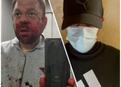 Избивший общественника из Югорска мужчина признал свою вину и записал видеообращение с извинениями. Но примириться так и не удалось